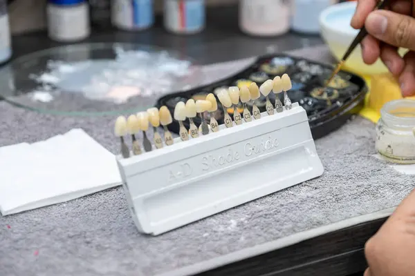 stock image male checking A-D shade guide for tooth crowns to select the proper tooth color in technician lab