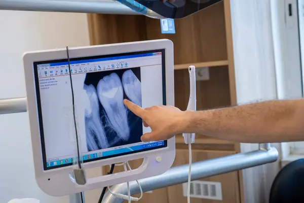 Diş hekimi ve Müslüman kadın arasında yapılan konuşma ekrandaki diş röntgenine bakarak ve doktor bu tür bir hastalık ve diş ağrısından kaçınmak için tedavi planını anlatıyor.