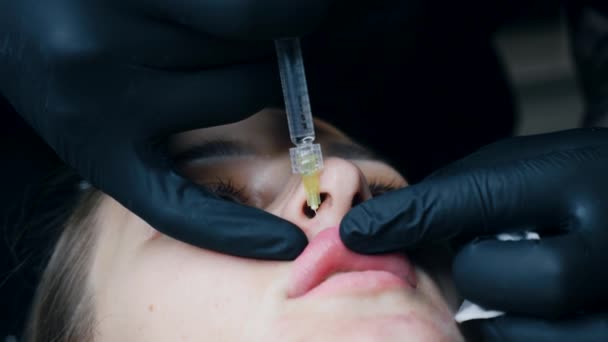 Lip Augmentation Procedure Close Female Lips Male Surgeon Injectionist Carefully — Stock Video