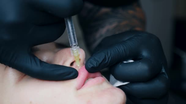 Procedura Powiększania Warg Zbliżenie Kobiece Usta Mężczyzna Chirurg Wstrzykiwać Ostrożnie — Wideo stockowe
