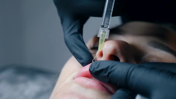 Läppförstoringsförfarande Närbild Kvinnliga Läppar Manlig Kirurg Injicerar Försiktigt Och Långsamt — Stockvideo