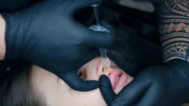 Lippenvergrößerung Nahaufnahme Weibliche Lippen Der Männliche Chirurg Spritzt Der Frau — Stockvideo