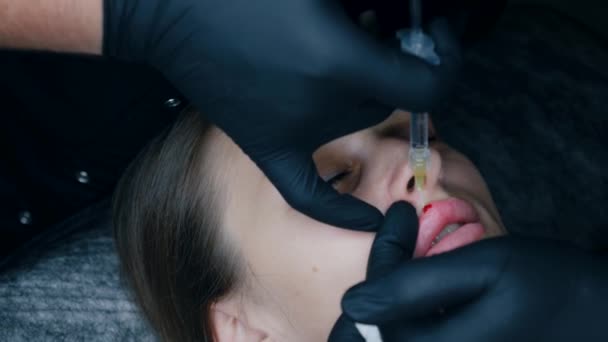 Lip Augmentation Procedure Close Female Lips Male Surgeon Injectionist Carefully — Stock Video