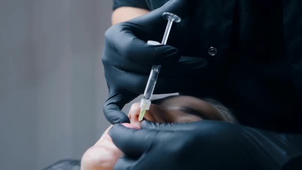Procedimento Aumento Labial Close Lábios Femininos Homem Cirurgião Injecionista Cuidadosamente — Vídeo de Stock