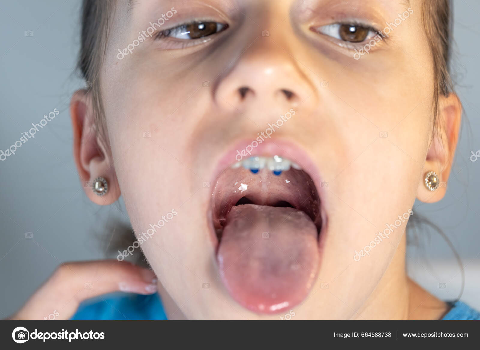 child girl open mouth Child Girl Open Her Mouth Show Her Tounge Concept Dentistry — Stock Photo © puhimec #664588738