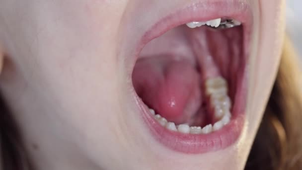 Une Enfant Fille Ouvre Bouche Montre Son Salon Concept Dentisterie — Video