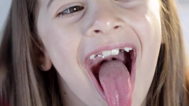 一个小女孩张开嘴 展示她的休息厅 牙科学的概念 牙齿矫正 — 图库视频影像