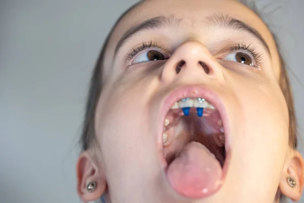 Een Kind Opent Haar Mond Toont Haar Toonzaal Het Concept — Stockfoto