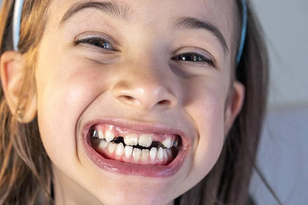 stock image Little happy kid girl at dentist office smiling showing overbite teeth, child during orthodontist visit and oral cavity check-up, children tooth care and hygiene.