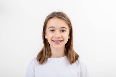 Beyaz bir arka planda diş telleri ile gülümseyen esmer beyaz kız izole edilmiş, diş sağlığı konsepti.