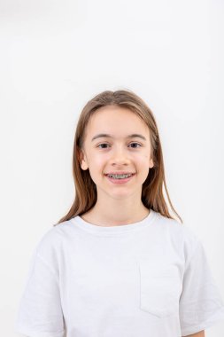 Beyaz bir arka planda diş telleri ile gülümseyen esmer beyaz kız izole edilmiş, diş sağlığı konsepti.