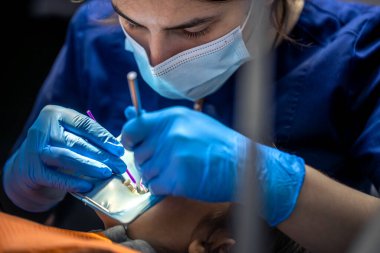 Dişçi kauçuk baraj kullanarak çocuğun dişini tedavi ediyor. Diş tedavisine yakın çekim. Yüksek kalite fotoğraf. Dişçi muayenehanesi. Dişçi konsepti. Dişe kauçuk baraj takmak.