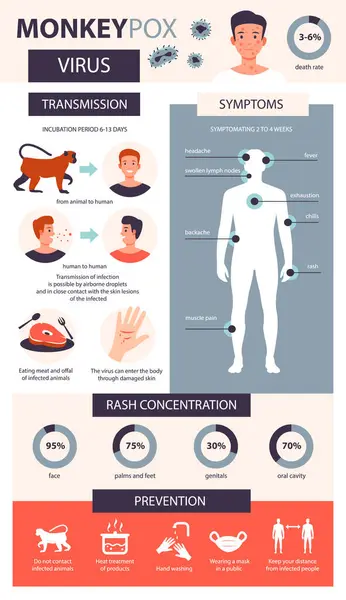 Monkey Pox Infographic Infection Symptoms Prevention Disease Monkey Pox Flat — Stock Vector