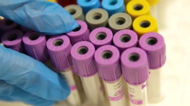 Mavi eldiven, laboratuarda durup test tüpünü tutabilmek için vakum tüpü yerleştirdi. Mikro küp. Vakum kan toplama tüpü.