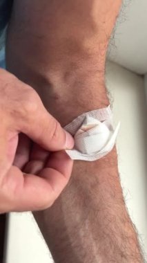 Film, kıllı koluna yapışmış damardan kan bandını aldıktan sonra yapışkan bandı çıkarır. Yüksek kalite 4k görüntü