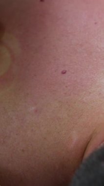 Kadın doktor rehabilitasyon terapisti erkek masajı için esneme hareketleri yapıyor. Omurgasını yerine oturtuyor. Hasta omurgasını kurtarıyor. Yüksek kalite 4k görüntü