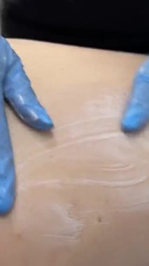 Modern güzellik tedavisi. Spa salonunda bacaklardaki fazla selüliti alıyor. Cilt tazeleme. VelaShape, vücut hatları ve selülit azaltılması için kullanılan cerrahi olmayan tıbbi bir cihazdır.