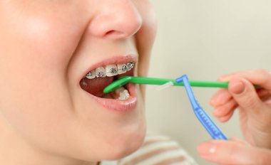 Muayene sırasında bir dişçinin dişlerini diş aynasıyla incelerken..