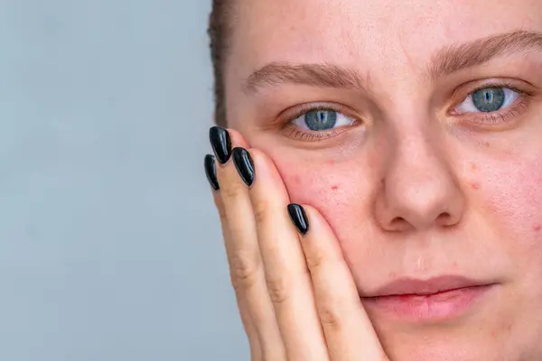 Bir kadının portresini yakından çek. Güzellik ve cilt sorunları konsepti. Yüksek kalite fotoğraf