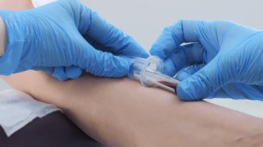 Bir hemşire hastanede test etmek için kan örneği alır. Laboratuvarda test için bir damardan kan alınır. Lastik eldivenli bir doktor iğneyle damarı deler..