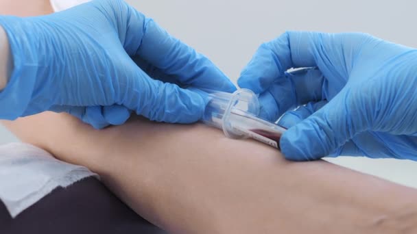 간호사는 병원에서 검사를 샘플을 수집합니다 혈액은 실험실에서 테스트를 정맥에서 가져옵니다 — 비디오