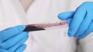 Tıbbi eldiven giyen bir doktor elinde kan örneği olan bir test tüpü tutuyor. Doktorun ellerinde kan olan bir test tüpü..