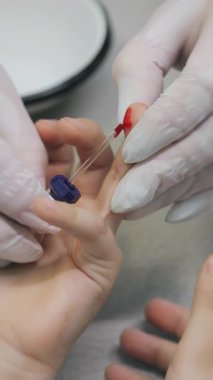 Doktor, klinikteki bir parmak iğnesinden hastadan kan örneği alıyor. Childs 'ın kan testi. Kan testi, kan grubu kararlılığı ve tıp konsepti. Hastanede küçük bir çocuk. Dikey video.