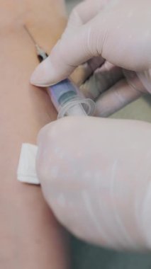 Bir hemşire damardan kan alır. Doktor hastadan analiz için kan alır. Hastanın kan analizi. Dikey video.