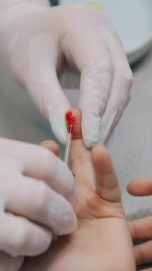Doktor, klinikteki bir parmak iğnesinden hastadan kan örneği alıyor. Childs 'ın kan testi. Kan testi, kan grubu kararlılığı ve tıp konsepti. Hastanede küçük bir çocuk. Dikey video.