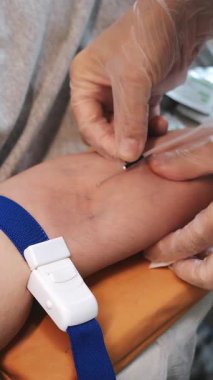 Hasta damarına iğne batıran koruyucu eldivenler giyen bir doktorun yakın çekimi. Hastanedeki bir hastaya damardan ilaç verilmesi. Dikey video.