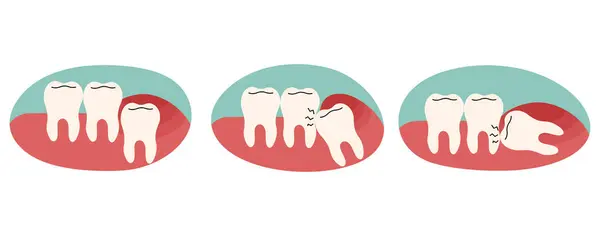 Wisdom Teeth Cute White Background Vector Illustration — Image vectorielle