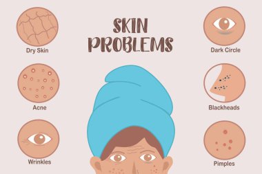 Cilt Farkındalığı Konsepti, Havluyla Kadın Kısmi Yüzü, Cilt Sorunlarının Vurgulanması, Bloglar İçin Harika, Skincare Klinikleri veya Eğitimsel Malzemeler