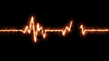 kalp atış çizgisi