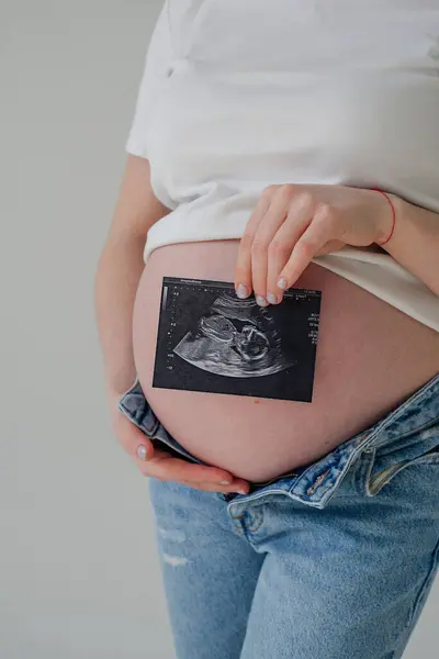 Karnını ve ultrason resmini tutan genç hamile kadın, dikey görüntü.