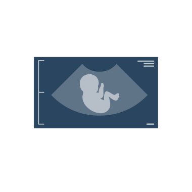 Ultra sound fetus unborn child icon. Simple illustration of ultra sound unborn child vector icon logo isolated on white background