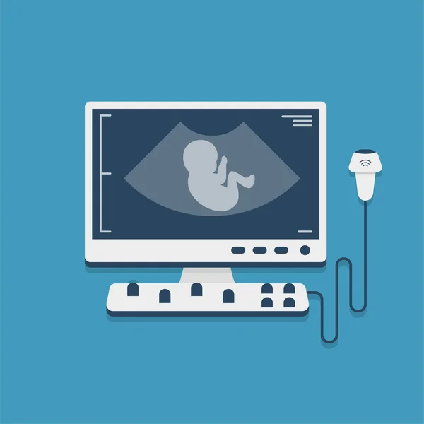 Ultrasound Scan Machine Hospital Examination Room Equipment Isolated White Background — Vetor de Stock