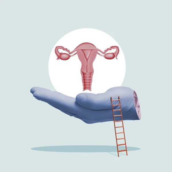 Modelo Sistema Reprodutivo Das Mulheres Colagem Arte — Fotografia de Stock