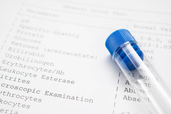 Close-up of a urine sample tube resting on a detailed medical test form. The form lists health markers like glucose and protein, all marked as absent, indicating a healthy result.