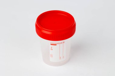 Laboratuvar testleri ve teşhisleri için kullanılan kırmızı vida kapaklı boş bir steril plastik numune konteynırına yakın çekim. 