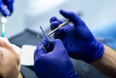 Ortodontist diş tellerine lastik takıyor..