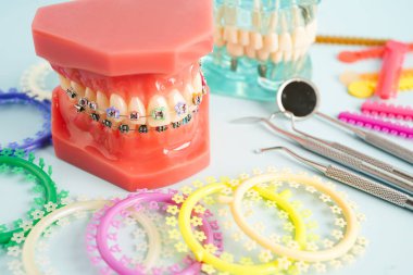 Orthodontic ligatures rings and ties, elastic rubber bands on orthodontic braces, model for dentist studying about dentistry. clipart