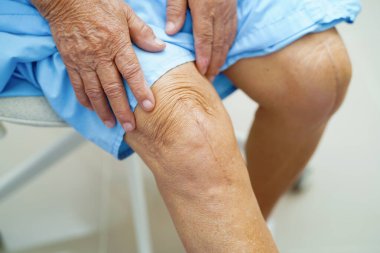 Asyalı yaşlı kadın hasta yaralarını gösteriyor. Diz eklemi ameliyatı. Yara eklemi artroplasti..