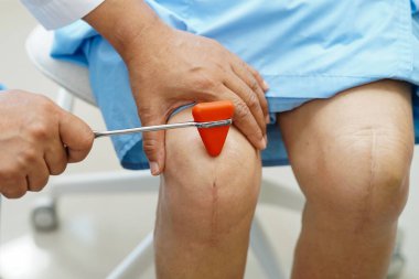 Doktor nörolog çekiçle refleks dizini test ediyor ve Asya 'nın son sınıf yaralarını gösteriyor.. 