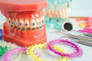 Ortodontik bağlar halkalar ve kravatlar, diş hekimliği üzerine çalışan dişçi için model..