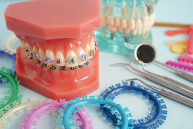 Ortodontik bağlar halkalar ve kravatlar, diş hekimliği üzerine çalışan dişçi için model..