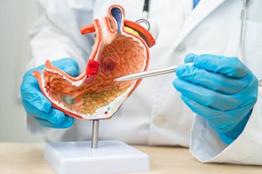 Dispsi ya da mide hastalığı, hastanede teşhis ve tedavi için mide anatomisi modeli tutan doktor..