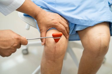 Doktor nörolog çekiçle refleks dizini test ediyor ve Asya 'nın son sınıf yaralarını gösteriyor..