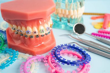 Ortodontik bağlar halkalar ve kravatlar, diş hekimliği üzerine çalışan dişçi için model..