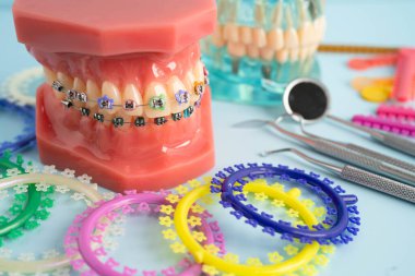 Ortodontik bağlar halkalar ve kravatlar, diş hekimliği üzerine çalışan dişçi için model..