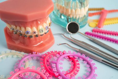 Ortodontik bağlar halkalar ve kravatlar, diş hekimliği üzerine çalışan dişçi için model..